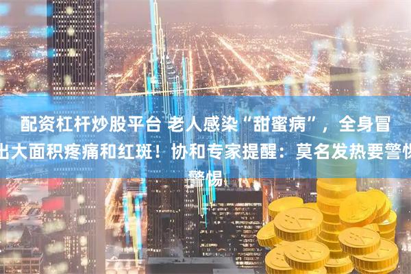 配资杠杆炒股平台 老人感染“甜蜜病”，全身冒出大面积疼痛和红斑！协和专家提醒：莫名发热要警惕
